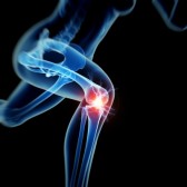 https://www.kneeandhip.co.uk/wp-content/uploads/2015/11/26850082-woman-having-acute-pain-in-the-knee.jpg